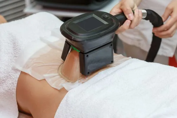 Image of person having fat freezing treatment to help weight gain Port Glasgow