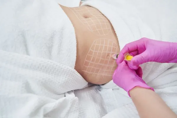 image of fat dissolving injections on love handles to help combat weight gain Port Glasgow