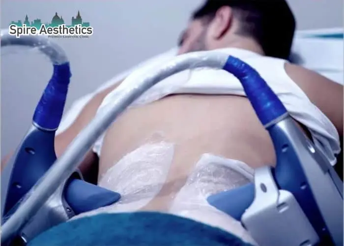 Man having fat freezing treatment done on love handles before a competitions Port Glasgow to create a sculpted look.